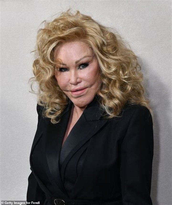 The Strange Life And Many Plastic Surgeries Of Jocelyn Wildenstein