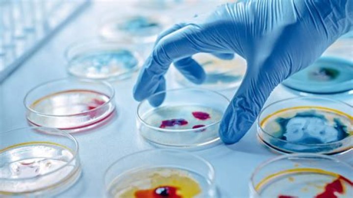 What is important of microbiology